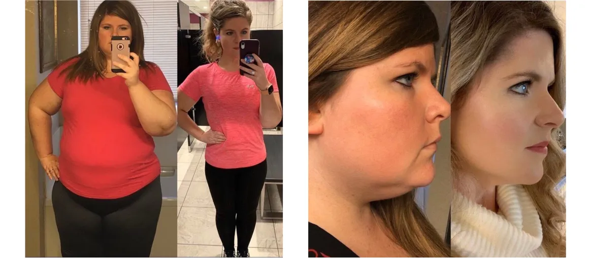 Key lessons from successful intermittent fasting weight loss transformations